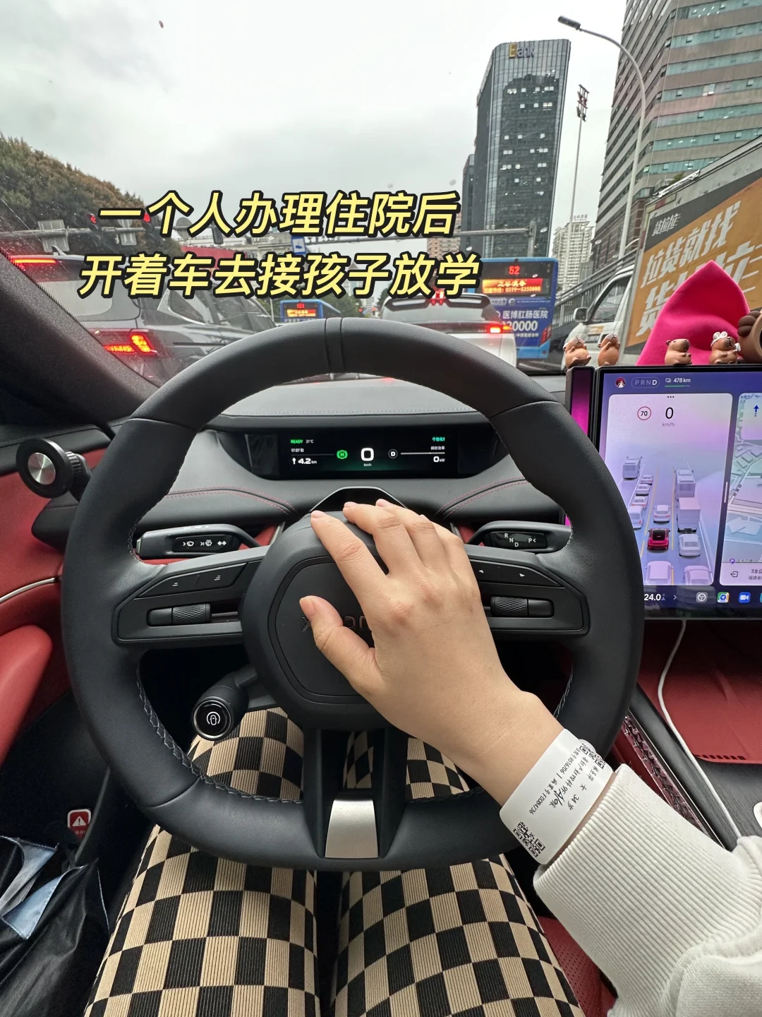 断更的日子，去医院开了四个洞