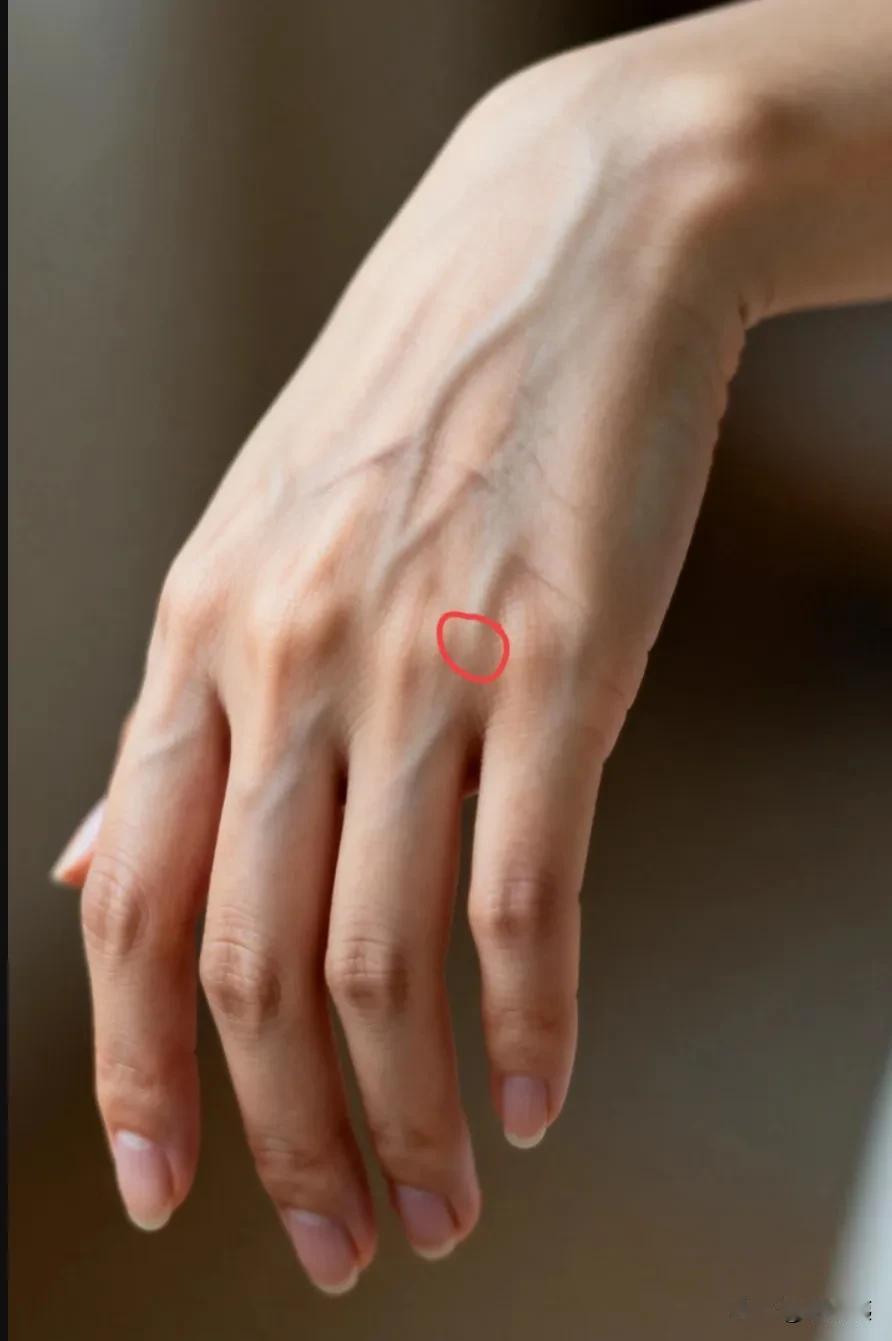 中医真的很神奇[赞][比心]
我因为前庭神经元炎头晕，出院后一边吃药一边做针灸。