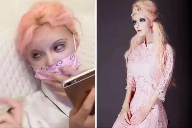 狠人一个，脸上动108刀，吃饭不敢张嘴，坚称没整容，富豪狂刷400万求真容 ​​