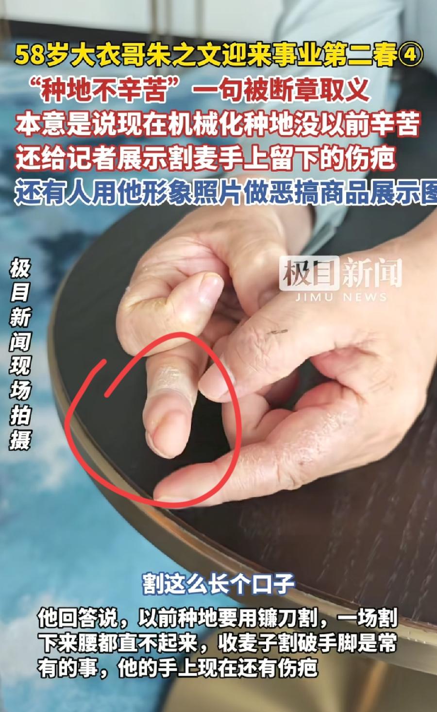 大衣哥的右手中指，割麦留下一道伤疤，肉都不圆乎了，像歪瓜裂枣一样，大衣哥年轻时真