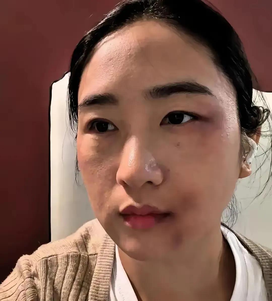 邻居王姐被家暴十几年，前天终于爆发了，她问初中儿子"你爸再打我你帮谁"，儿子头都