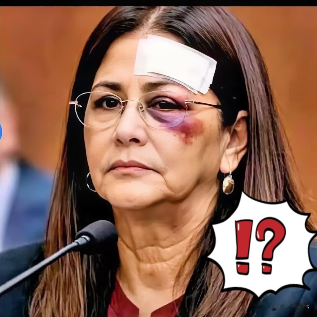 我的天呐！这照片看的我心里发毛。

马杜罗的妻子西莉亚出来了，瞧瞧那双眼睛红肿，