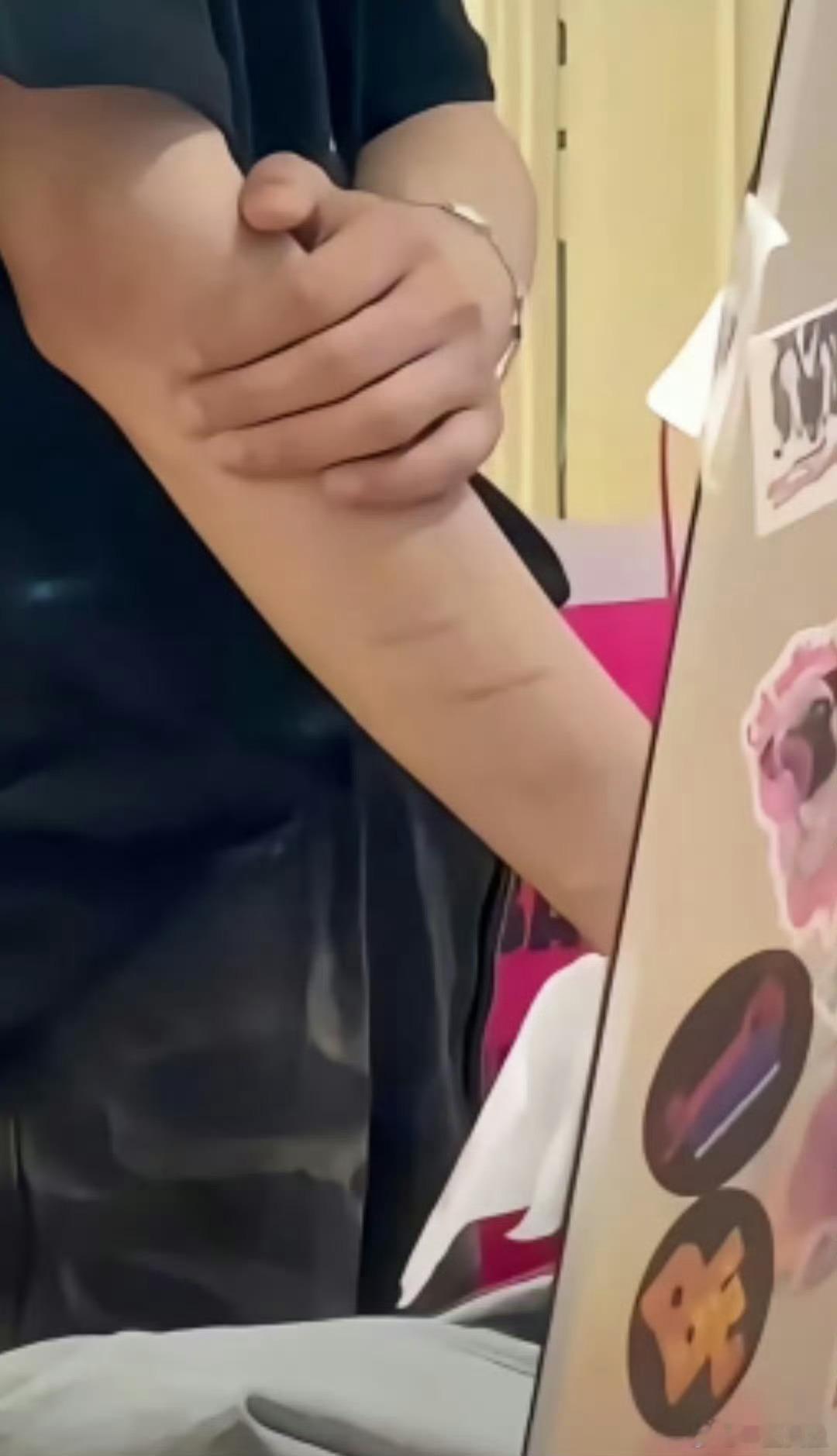 他是有抑郁症吗？ ​​​