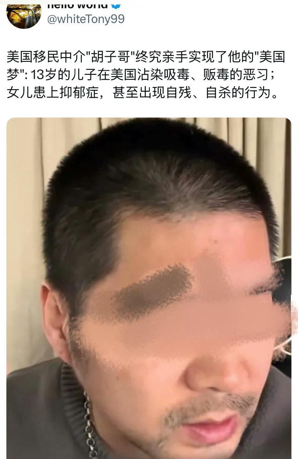 移民中介“胡子哥”发视频说他后悔了，他不该把孩子带去美国，现在两个孩子都出了问题