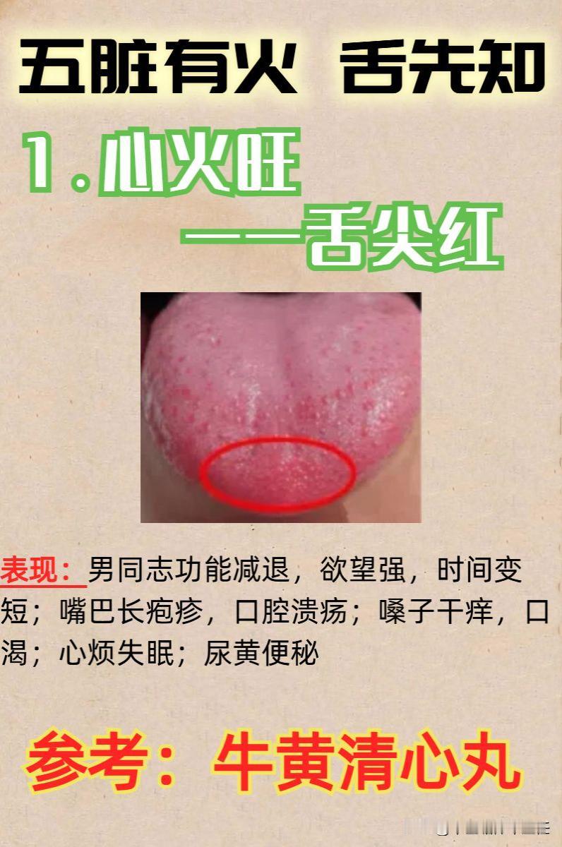 五脏有火舌先知，中医教你从舌面找出藏在身体的火！