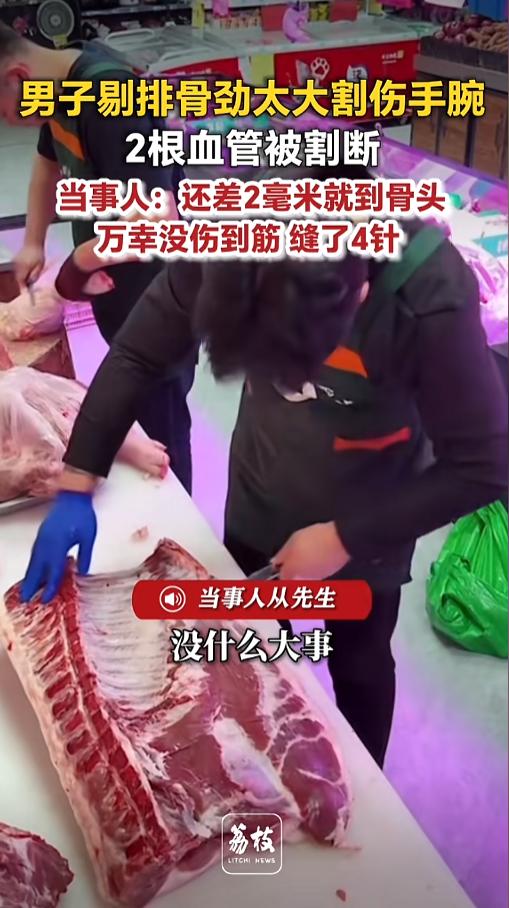 “太吓人了！”5月6日报道，浙江宁波，一男子出摊卖肉，剔排骨时，用力太猛，结果剔