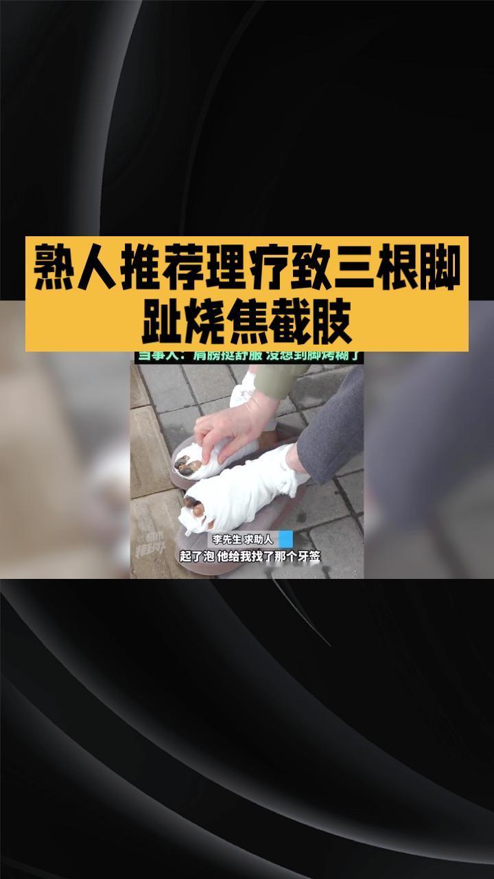 熟人推荐的“家中理疗”竟致三根脚趾烧焦截肢，责任该谁承担？
近日，河南54岁的李
