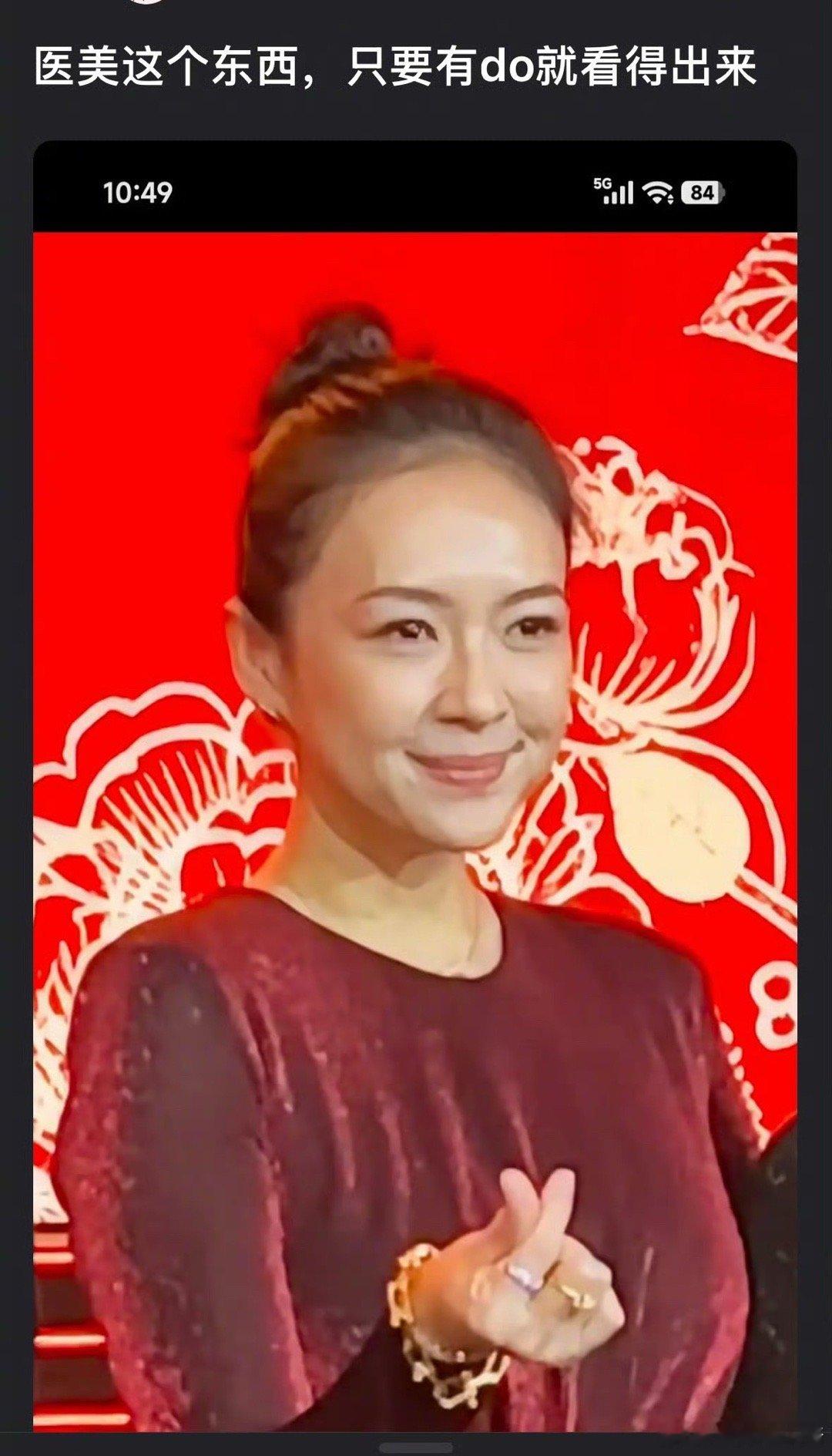 章子怡的脸和之前不一样吗 