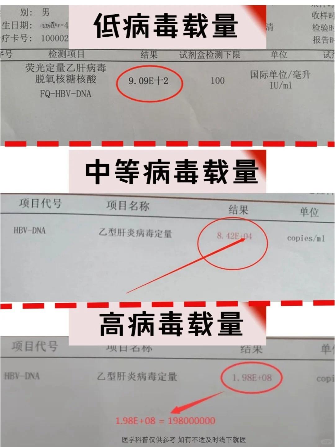 乙肝病毒定量高不高？一次给你讲清楚！。在临床上，我们通常按照以下标准来...