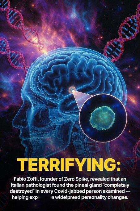 新冠疫苗完全摧毁松果体——这就是为什么每个人的个性都发生了变化吗？根据意大利 Z