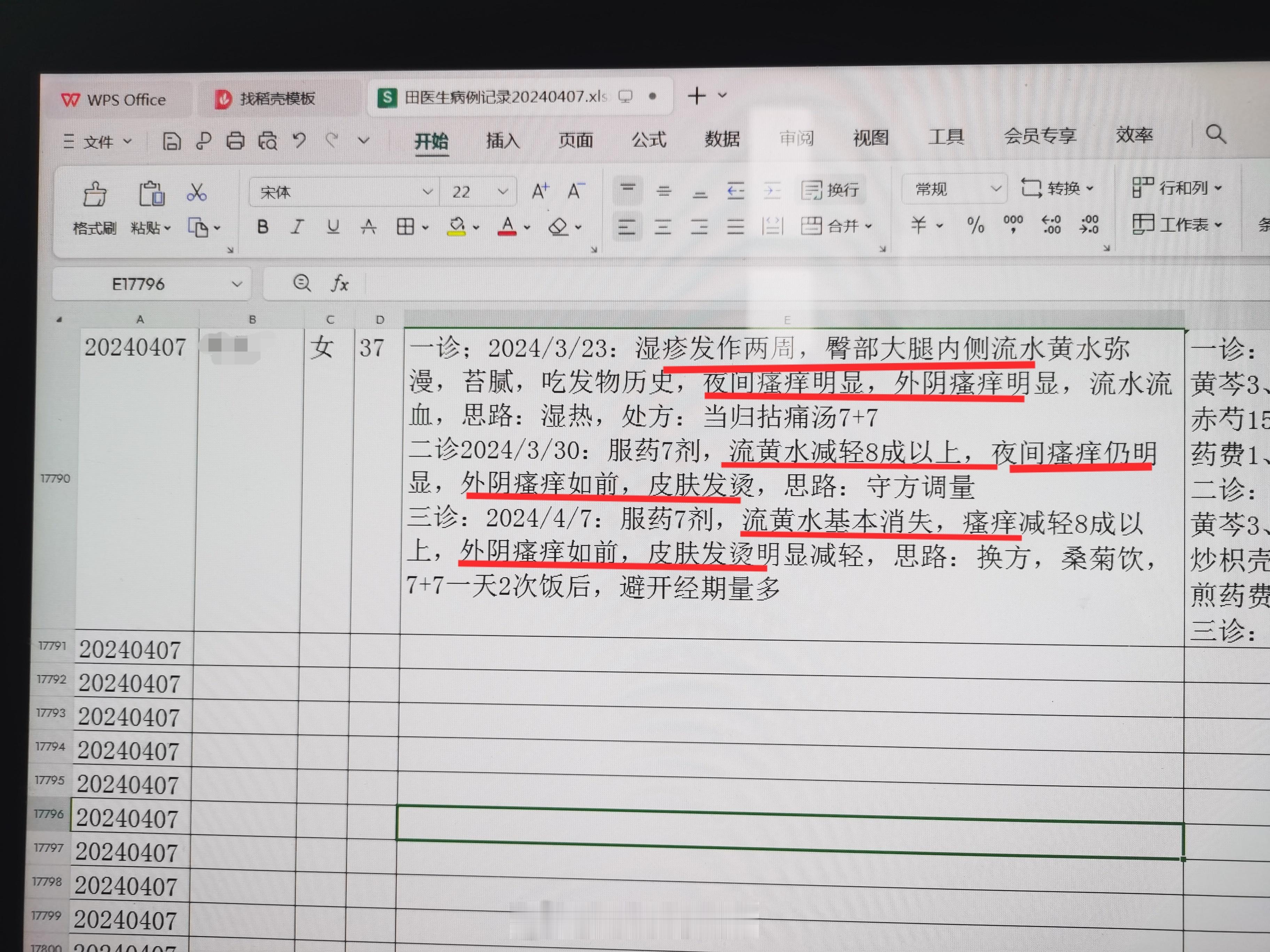 #中医##湿疹#  老患者 女 37岁，吃发物后臀部大腿大面积湿疹瘙痒明显，皮损