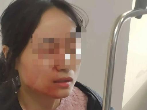 “好心没好报” 老师好心劝架，结果被学生用镊子戳穿眼球，最后还因为对方未满 14