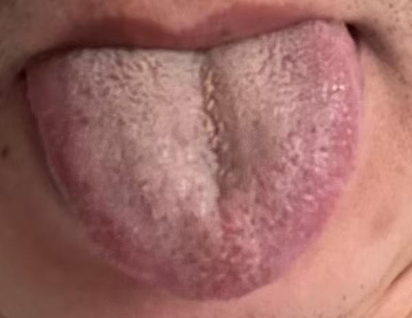 宗筋状态不佳多因下焦瘀堵，活血通络慢慢改善






有不少朋友问我对于顽固性