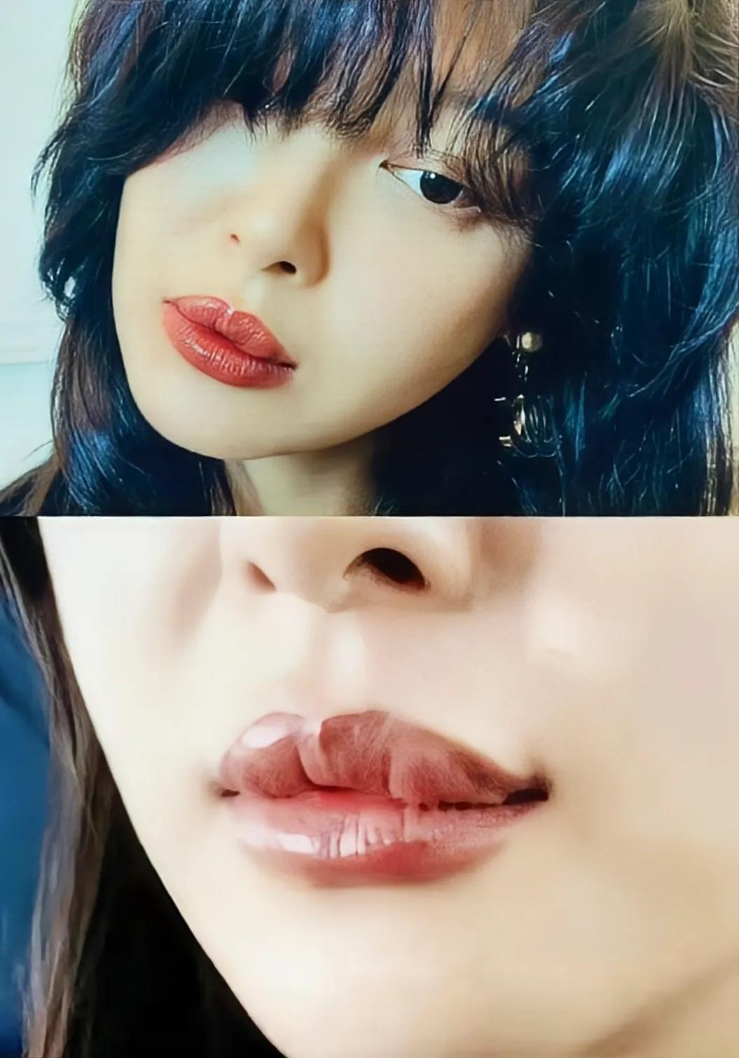 她的嘴中间为什么有个缝儿
