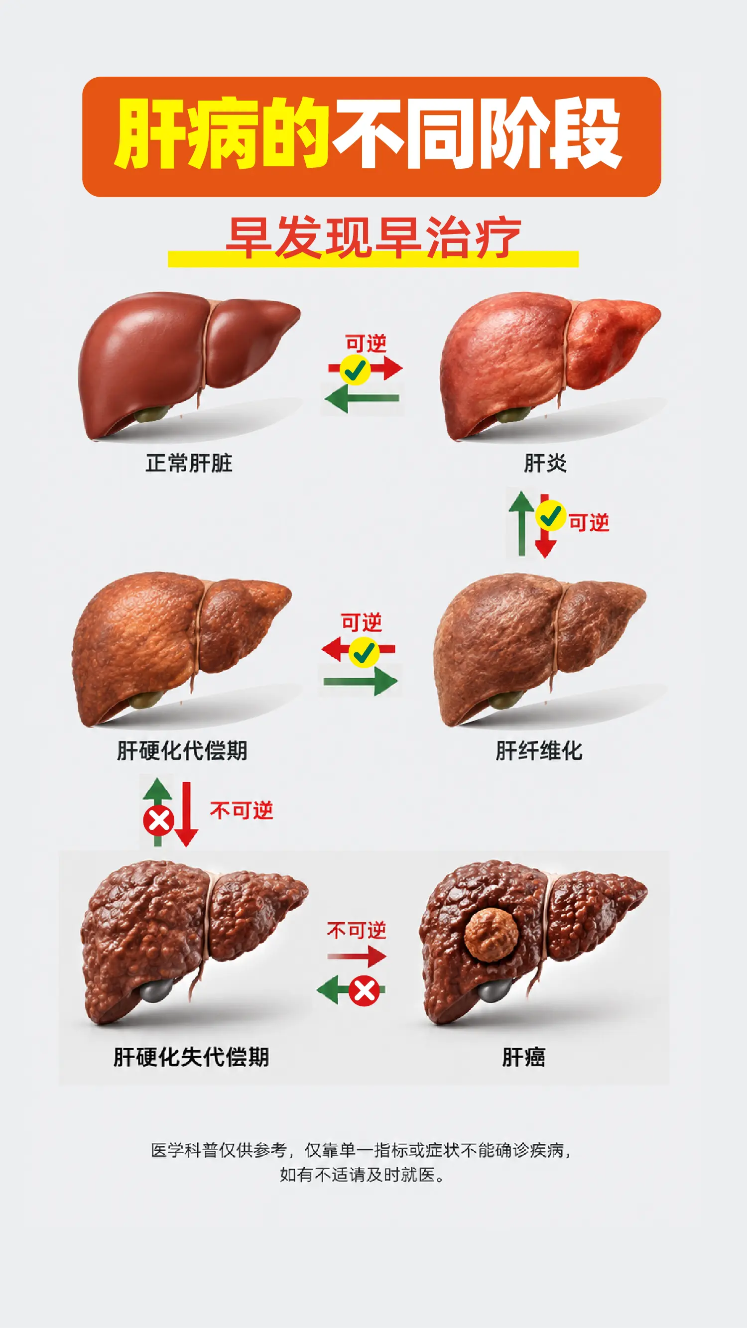 肝病的不同阶段，早发现早治疗。