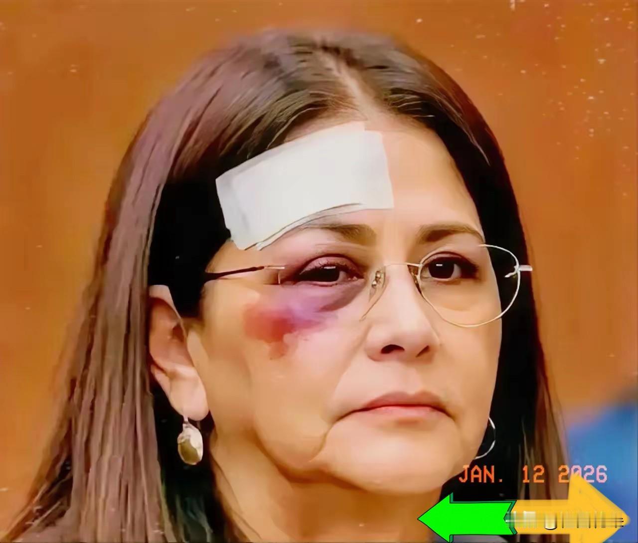 委内瑞拉总统夫人的那双红肿眼睛，看得人心里真不是滋味。
搞不过丈夫就拿妻子开刀，