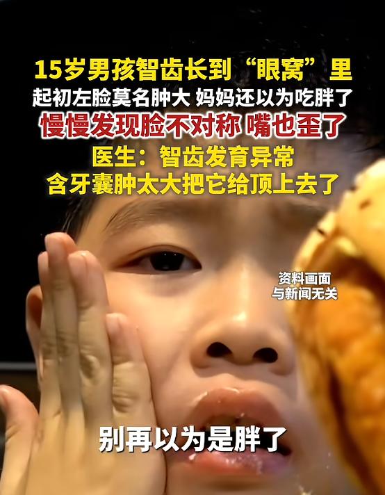 “活久见！”河南郑州，一15岁男孩左脸莫名肿大，妈妈刚开始还以为他吃胖了，后来慢