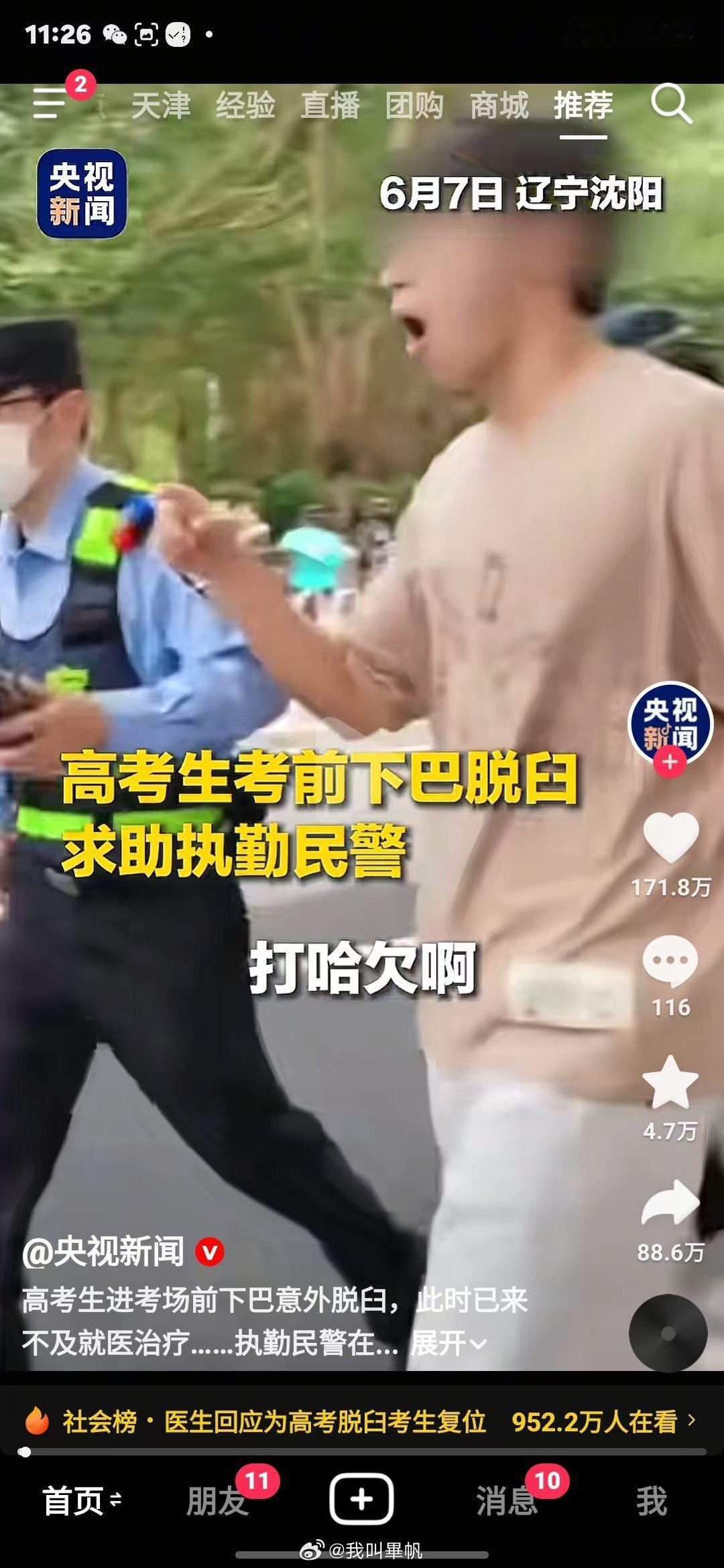 对不起，我以后都不敢打哈欠了