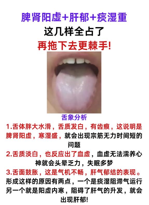 脾肾阳虚 + 肝郁 + 痰湿重，全占了别再拖！