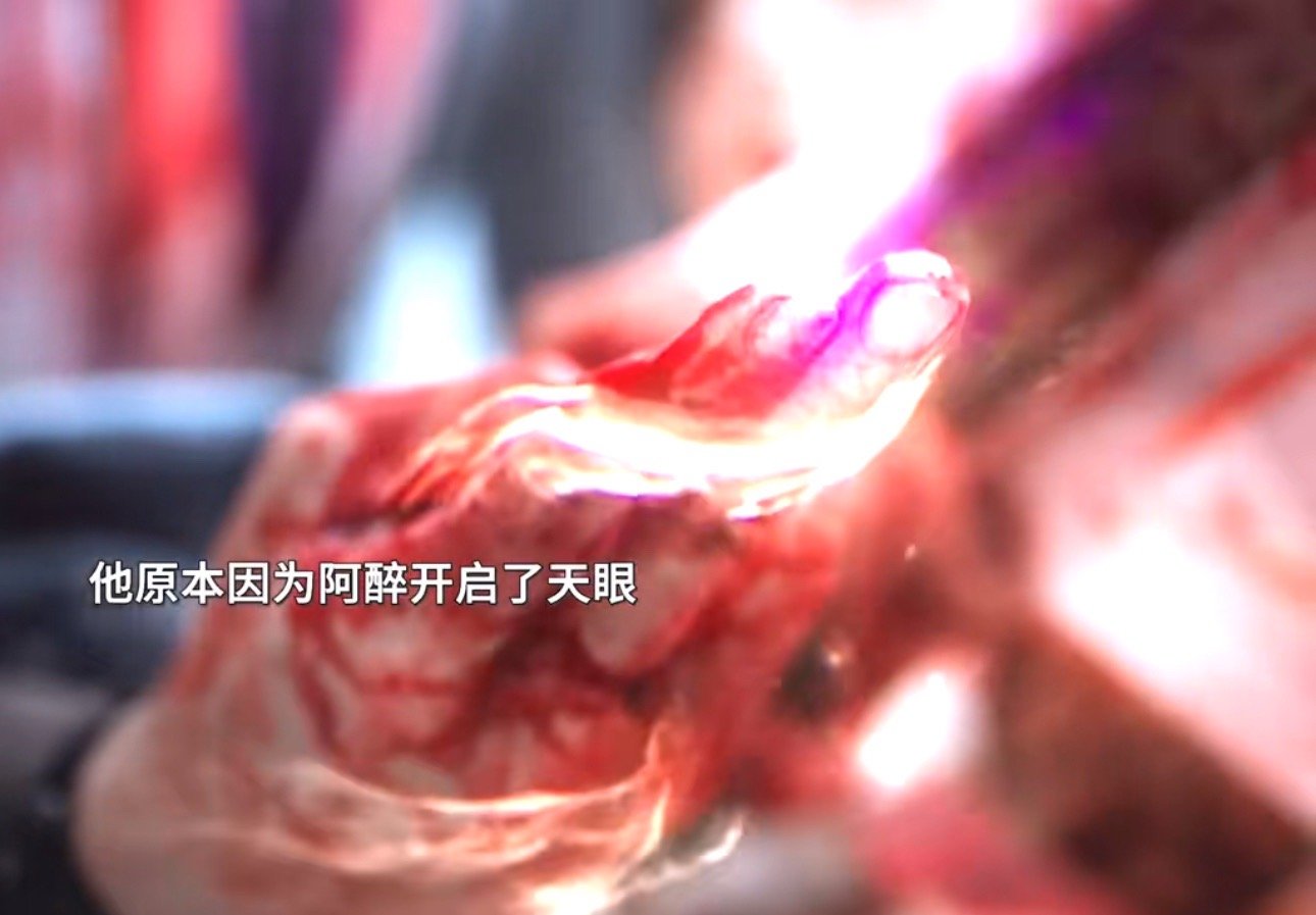 杨一叹醒来后自挖天眼杨一叹醒来后自挖天眼[泪]杨一叹自挖天眼 ​ ​​​