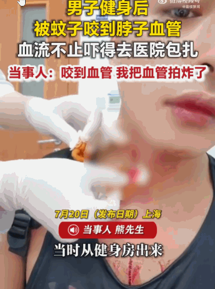 7月20日报道，上海，一男子从健身房出来准备打车，上车前感觉脖子被蚊子叮了一下，