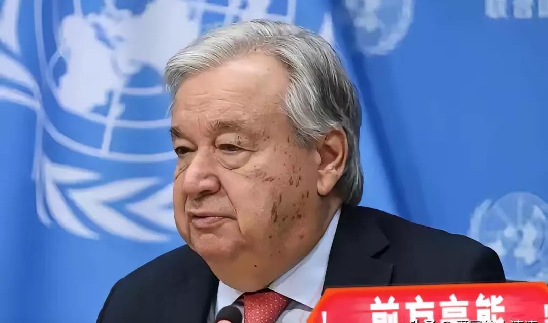 一声惊雷，从联合国总部传来！
​​​联合国秘书长古特雷斯向全世界通告：二战爆发是