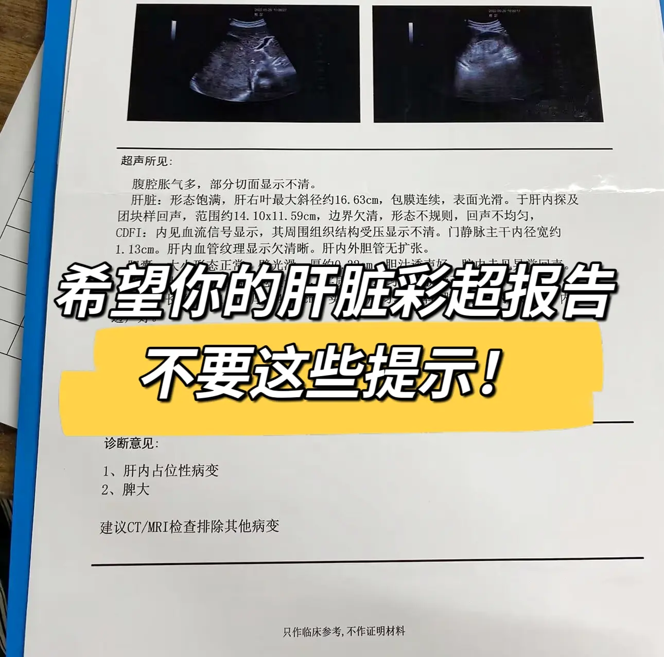 1.肝脏回声增粗增强：一出现这个提示，一般情况下表示可能是有肝病了，轻...