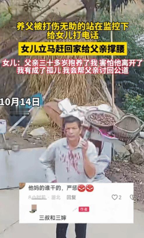 太欺负人了！10月14日，湖北，养父被三叔三婶打伤眼角，血染红了衣襟。他没有儿子