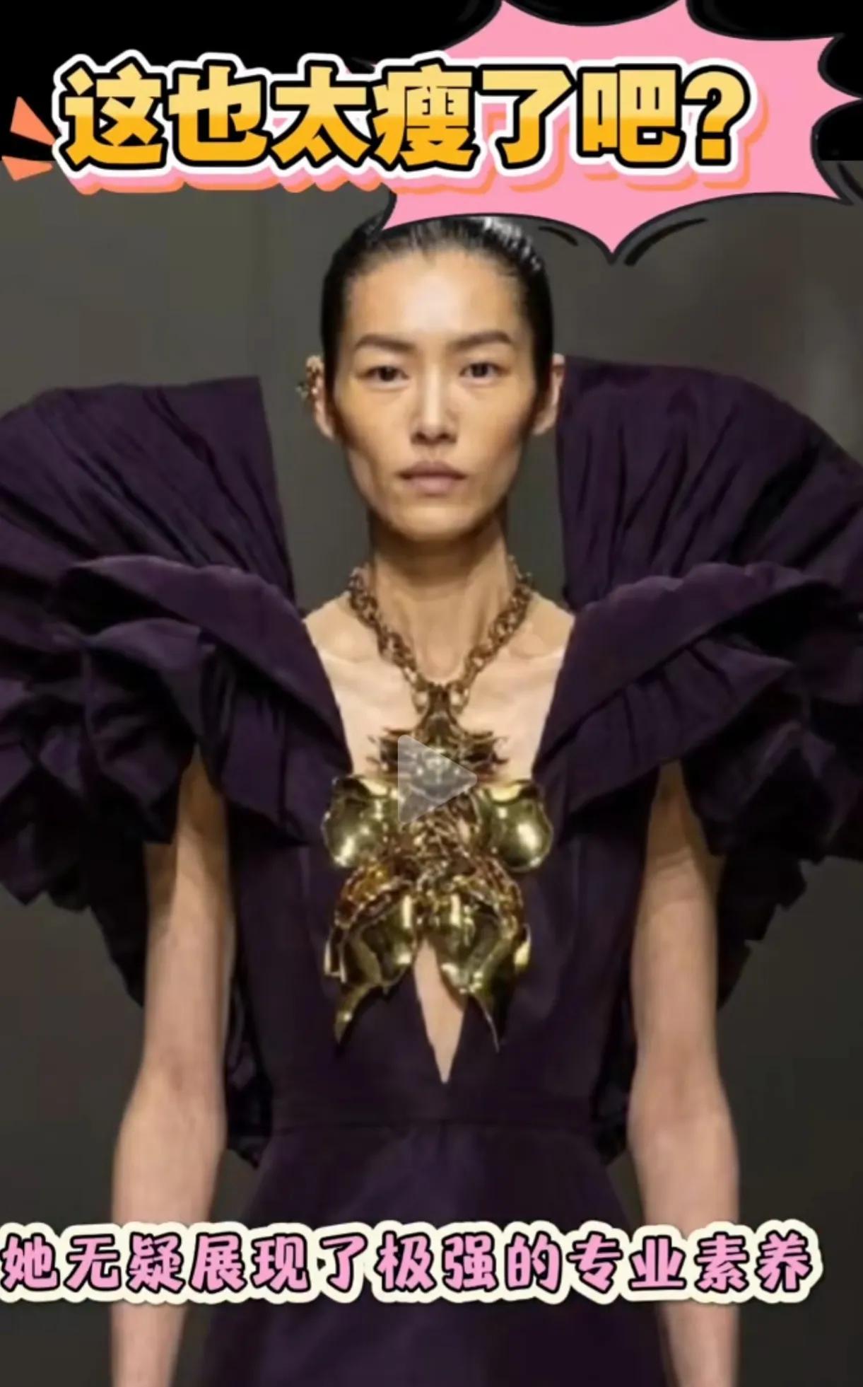 刘雯太瘦了，脸颊凹陷，瘦骨嶙峋，排骨明显。
瘦成这个模样，吃饭可能都不敢大胆吃，