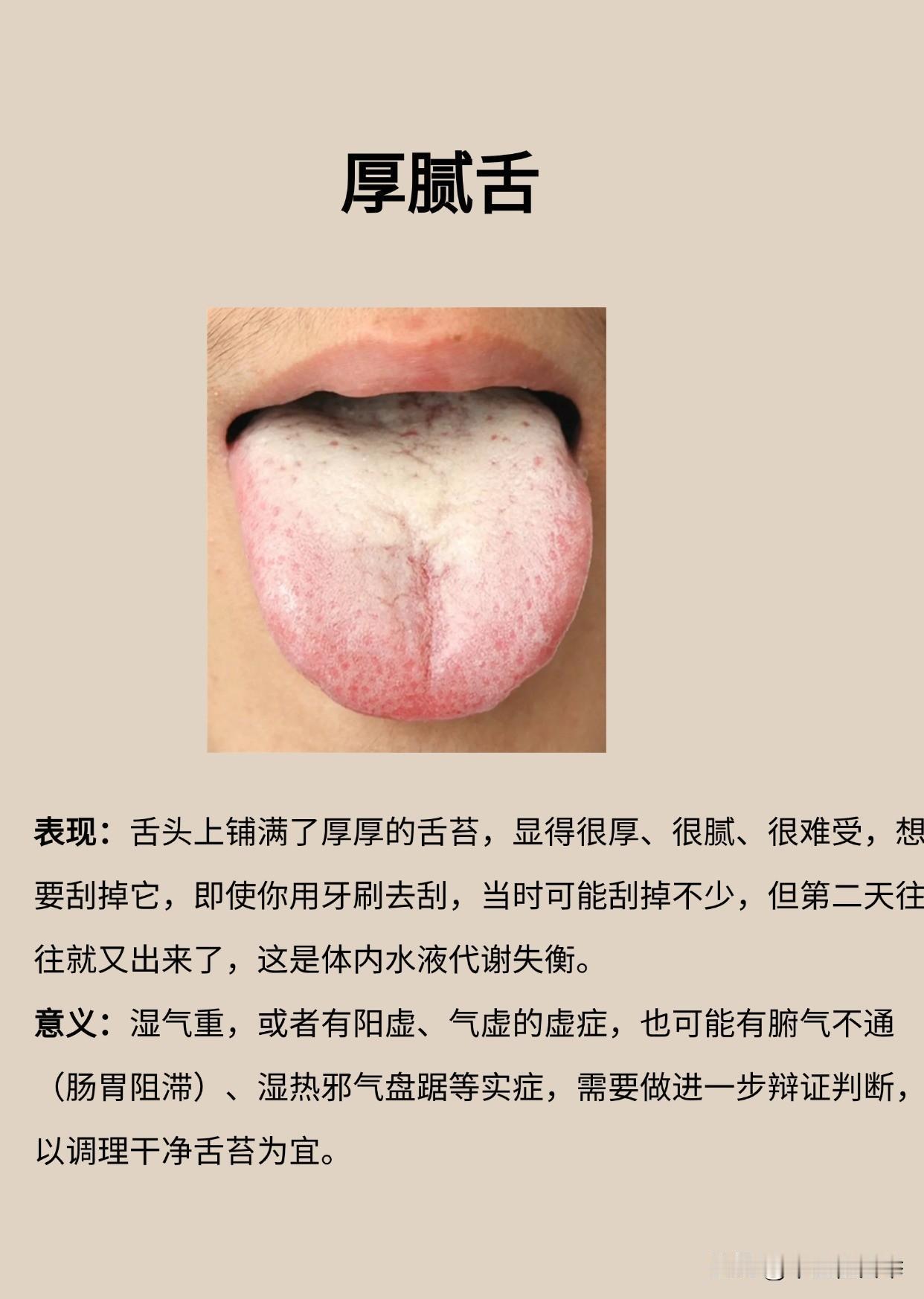 舌头出现这5种情况，是你的身体在发出“警报”！一定要马上看中医！
#中医##养生