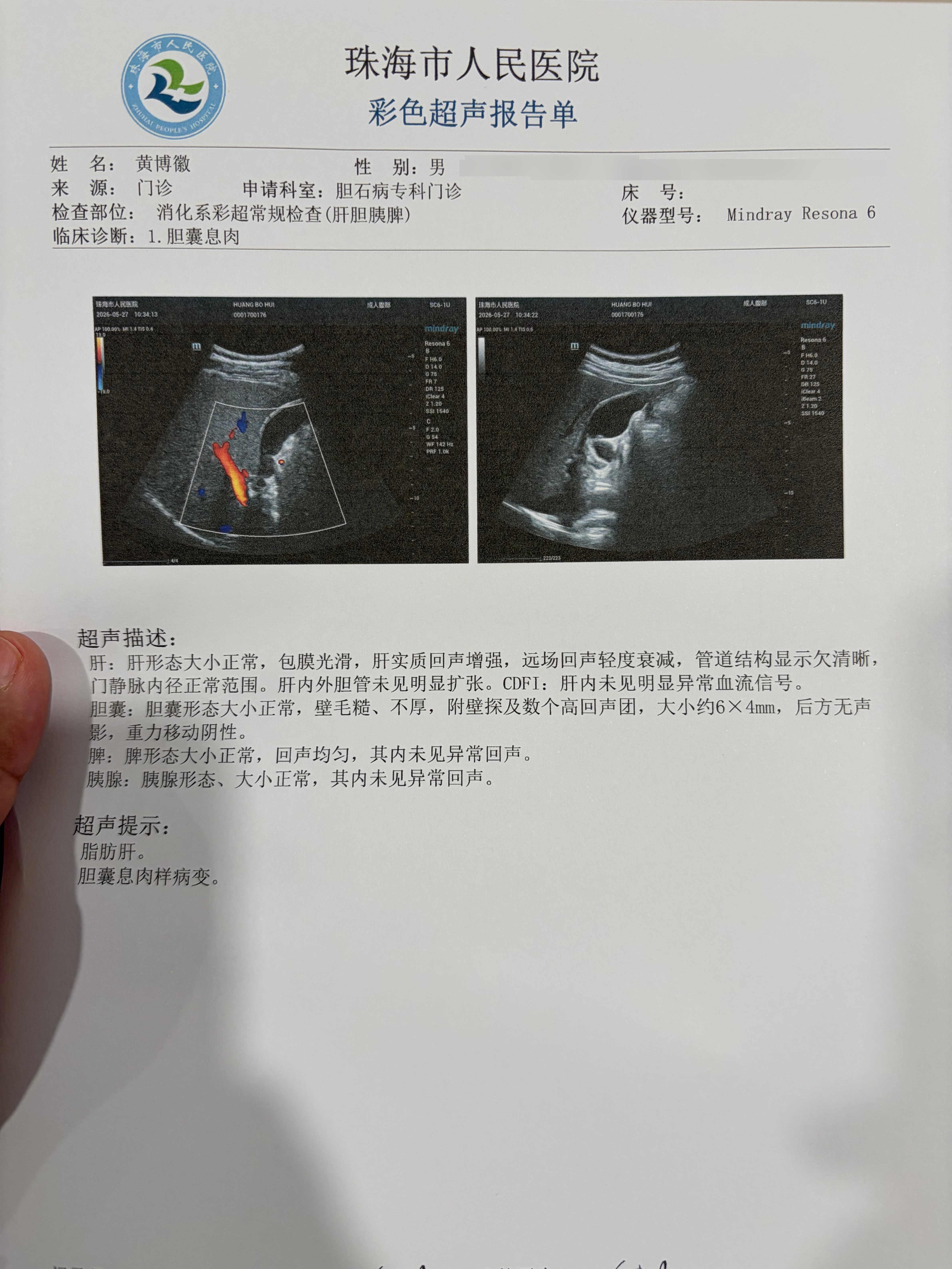我靠！痛疼位置没定位准咋办？凉拌？肝胆脾胰彩超，胆囊反而没啥大问题，息肉还在没见