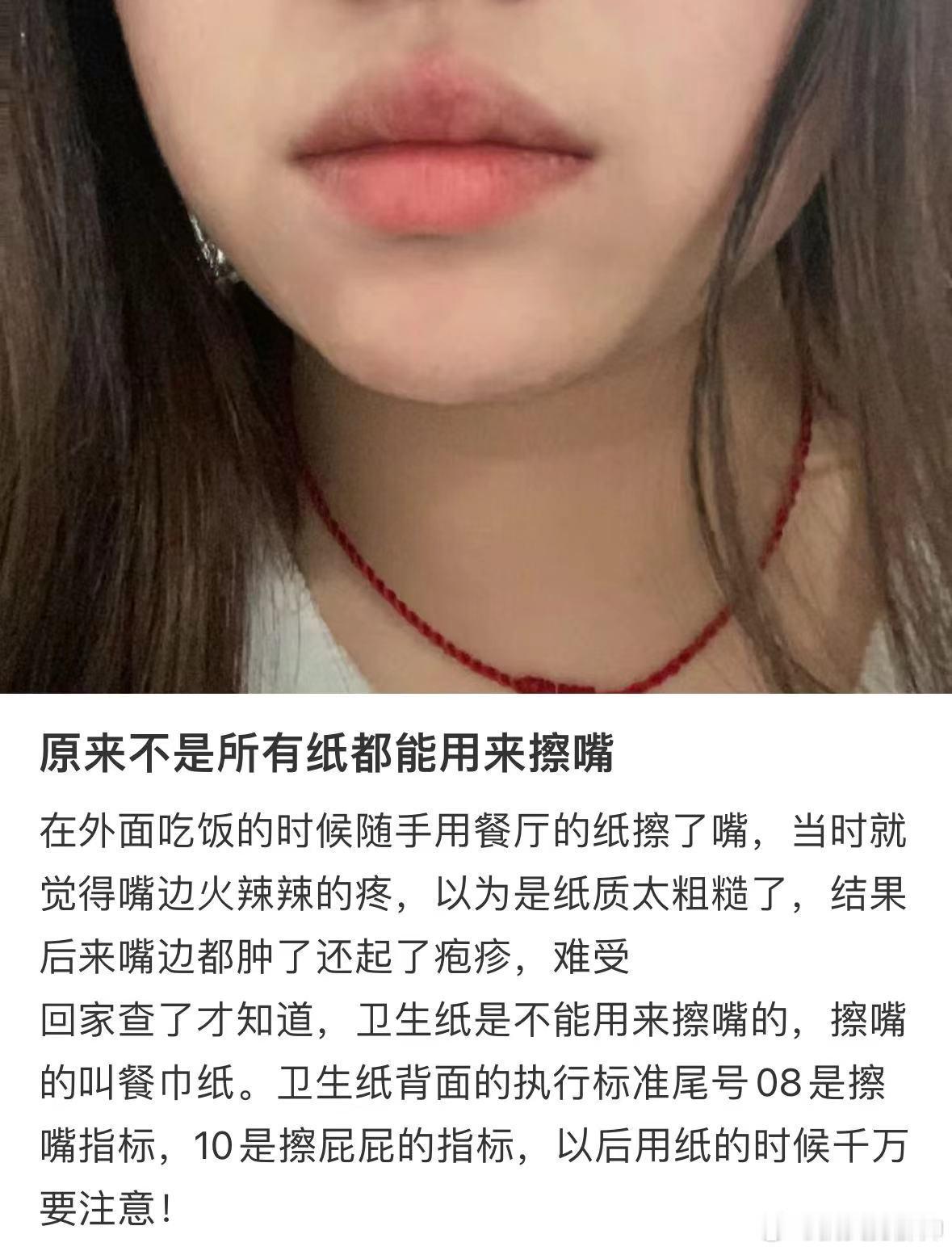 #原来不是所有纸都能用来擦嘴# 闺蜜用了外面的纸巾擦嘴居然烂嘴了！外面的一些纸巾