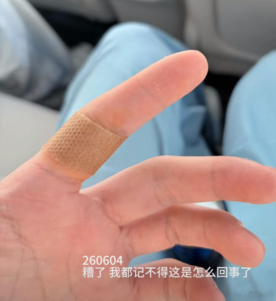 苏新皓手咋了苏新皓手受伤了自己不知道苏新皓好迷糊 
