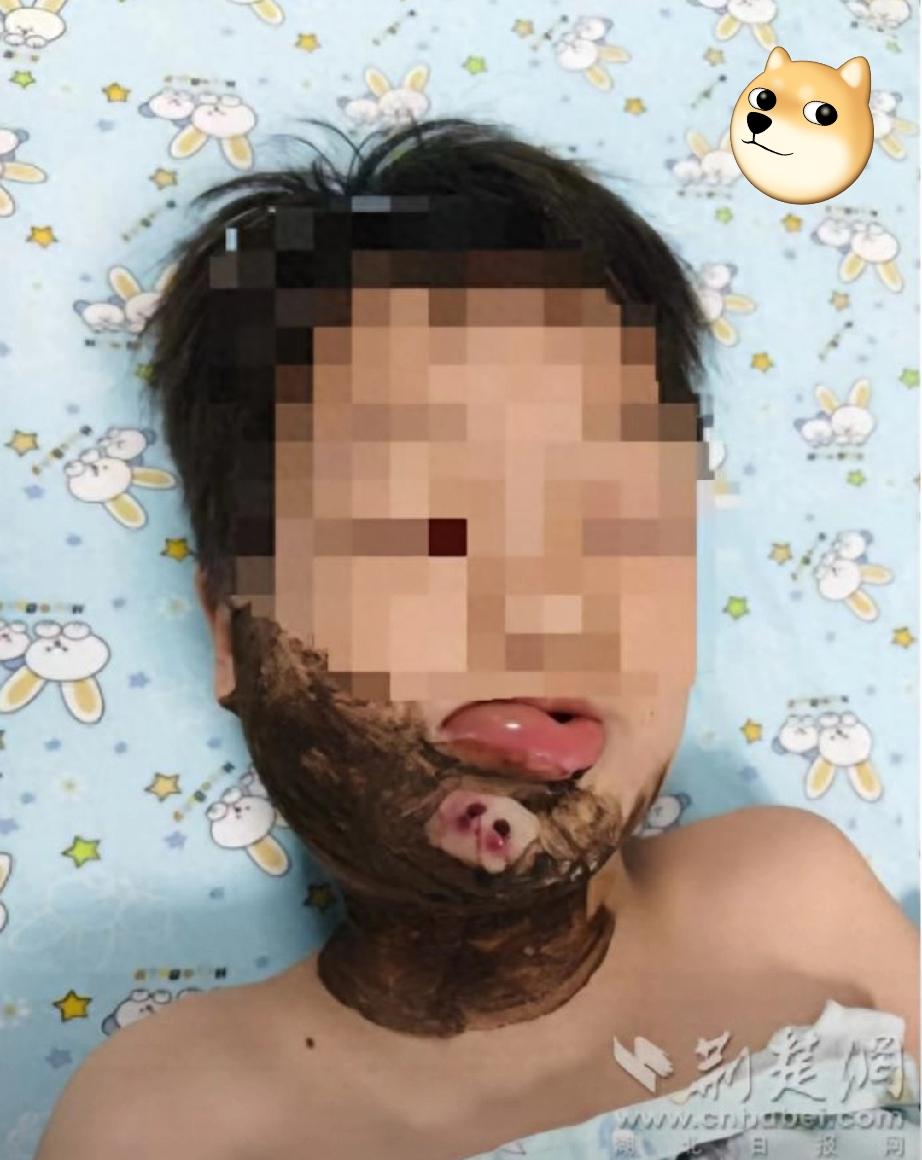 悲剧还是发生了！湖北襄阳，一8岁男童傍晚在浅滩踩水嬉闹时，一条细长黑影猛地从浑浊