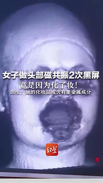 谁能想到！

    脸上的妆居然能让核磁机两次黑屏？

    杭州女子做头部