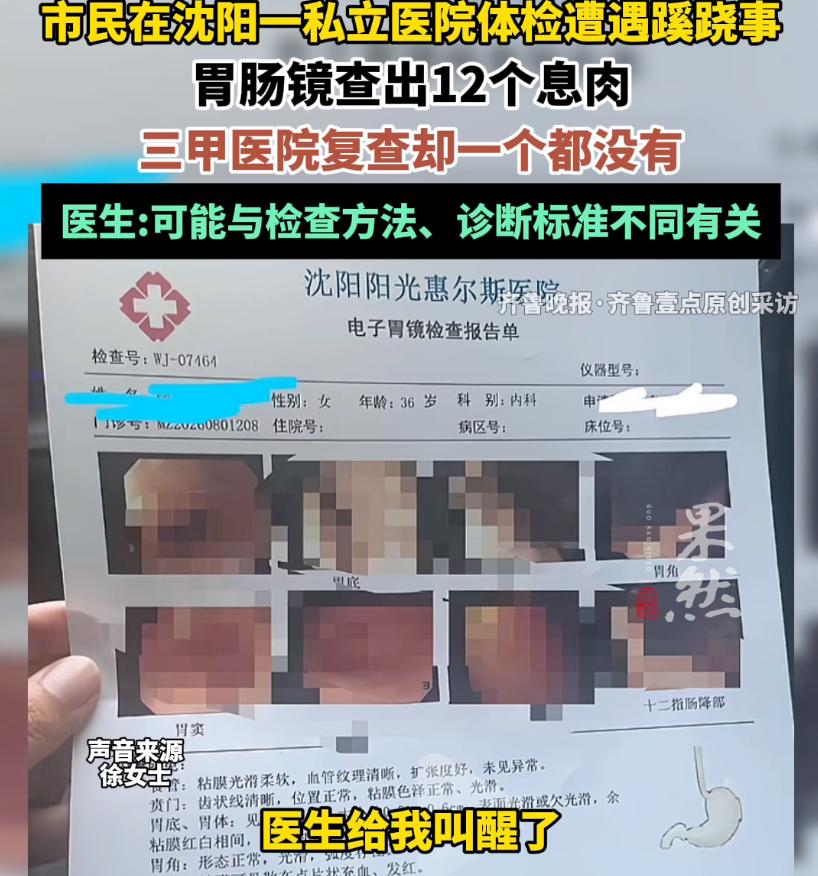 丧心病狂！辽宁沈阳啊，女子陪老公去单位体检，她自己顺道也加做了个胃肠镜。麻药劲儿