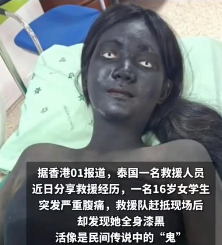 泰国，一救护车出任务，泰国少女通体漆黑送医、只剩眼白的少女，救援人员当场被吓懵！