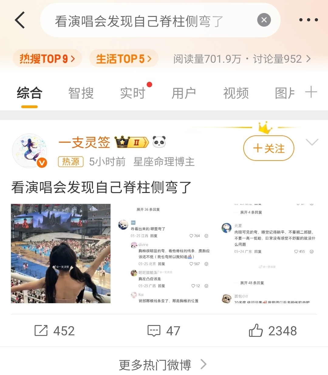 看演唱会发现自己脊柱侧弯了感觉这个人还好吧现在矫正应该还来得及如果翘脚的话多少都