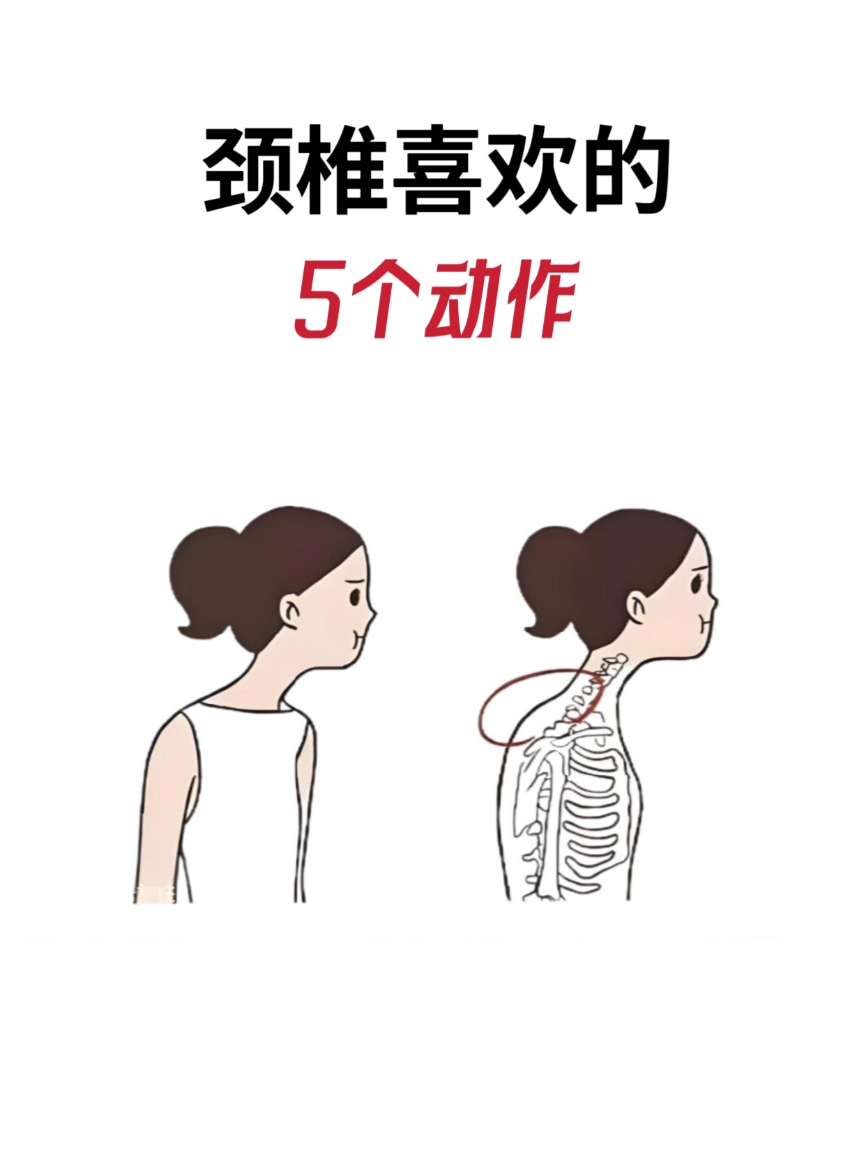 颈椎喜欢的5⃣个动作！1⃣遍就酥服✅ ​​​