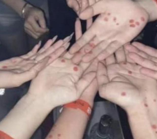 果然不愧是日本啊，真的是一次又一次刷新了我的三观底线，晒梅毒竟然成了他们那年轻人