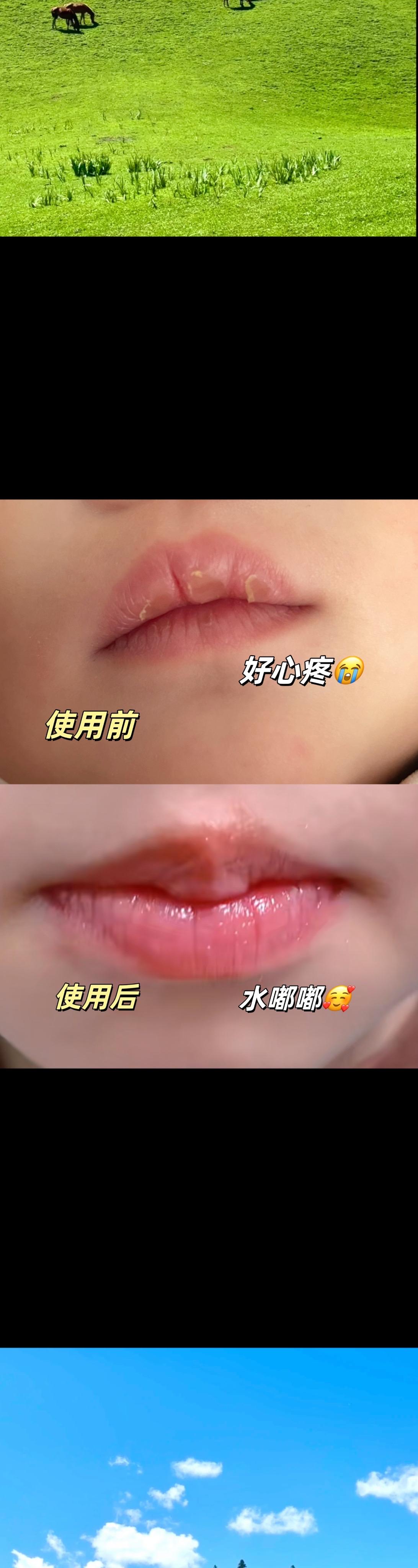 秋冬宝宝的嘴容易干巴起皮怎么办？滋润保湿