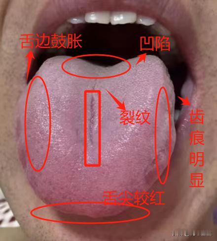这种肾亏像只会越补越虚，赶紧停下你的无脑进补行为！听我的话只需要一步到位

今天