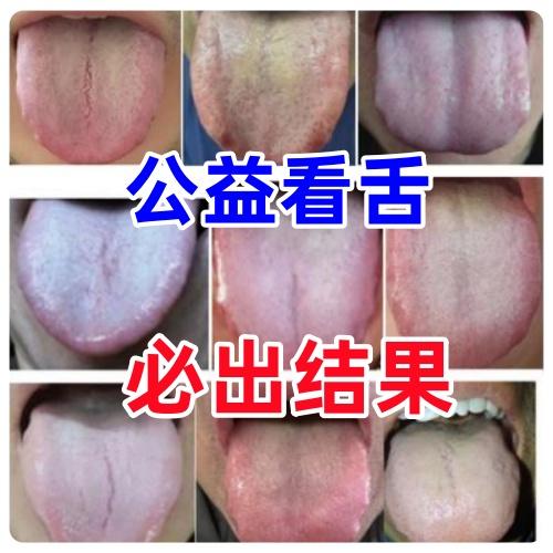 今天不值班，专门给大家看舌，我看舌从来都是公益的，一个不落，挨个分析！
！！
注