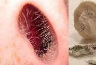 鼻毛变白是什么原因？
鼻毛变白：解码身体微小变化的隐秘信号

鼻毛，作为人体呼吸
