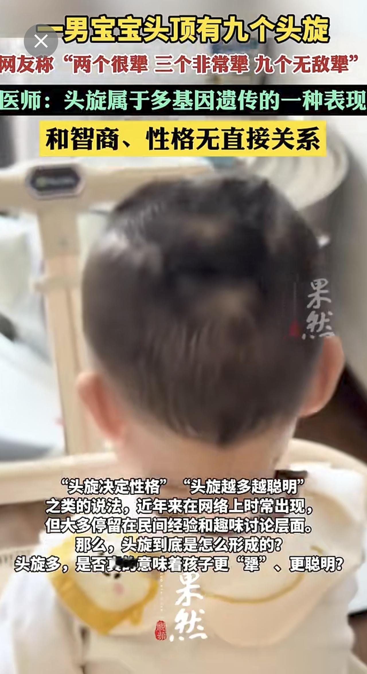 医师回应宝宝头顶九个旋：头旋属于多基因遗传的一种表现，和智商、性格无直接关系。
