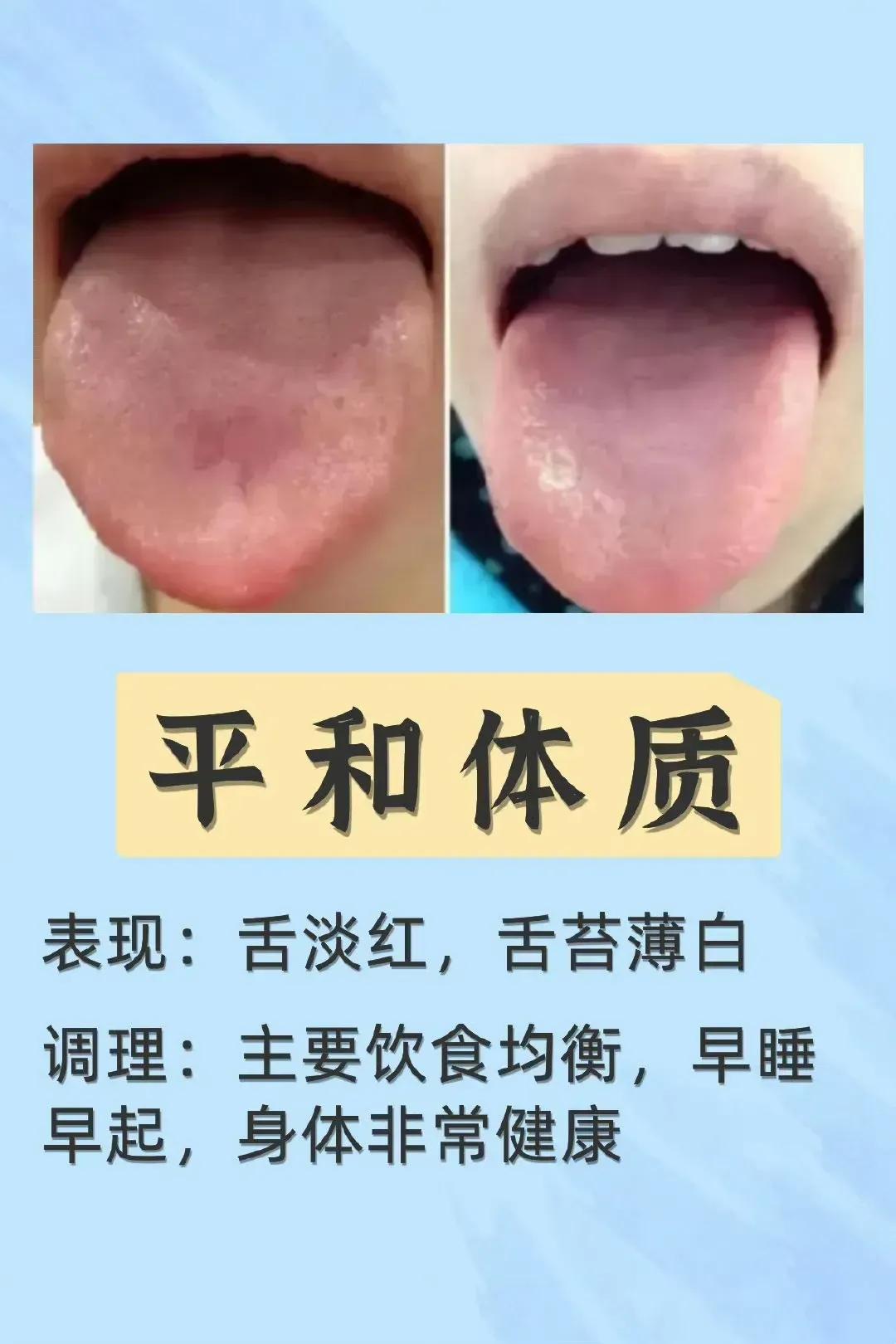 你是否知道，通过观察舌头，可以辨别出不同的体质类型？舌诊，这一神奇的中医技巧，让