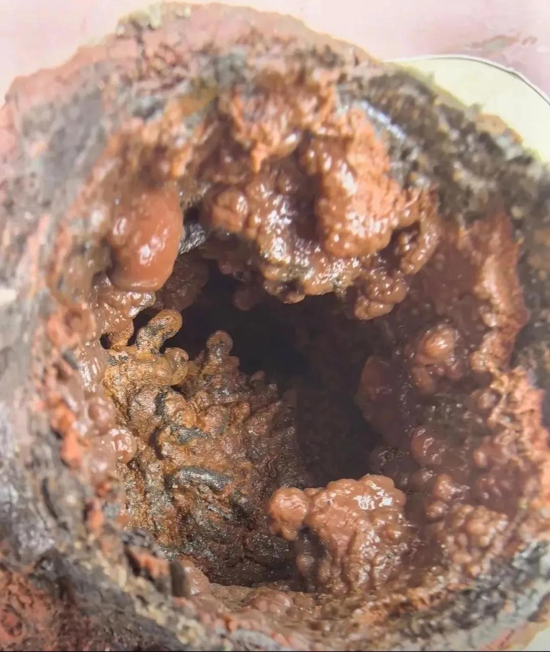 这是三十年的旧楼栋入水管，管内铁锈污泥堆积，象极了我们人体高血脂高血栓的血管，但