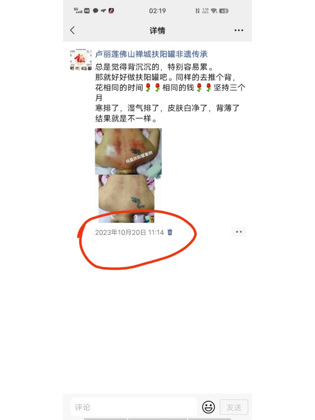 背不堵了，人就通透了｜扶阳罐调理实