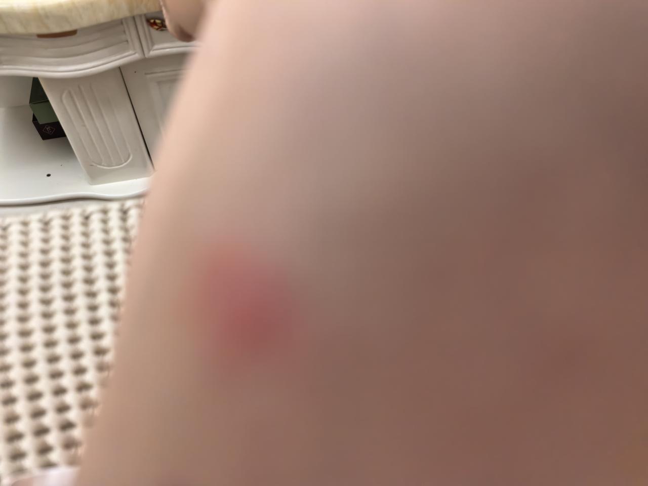 现在的蚊子都变种了吗？
前两天去菜地，捂得严严实实，还是被蚊子咬了，隔着衣服就能