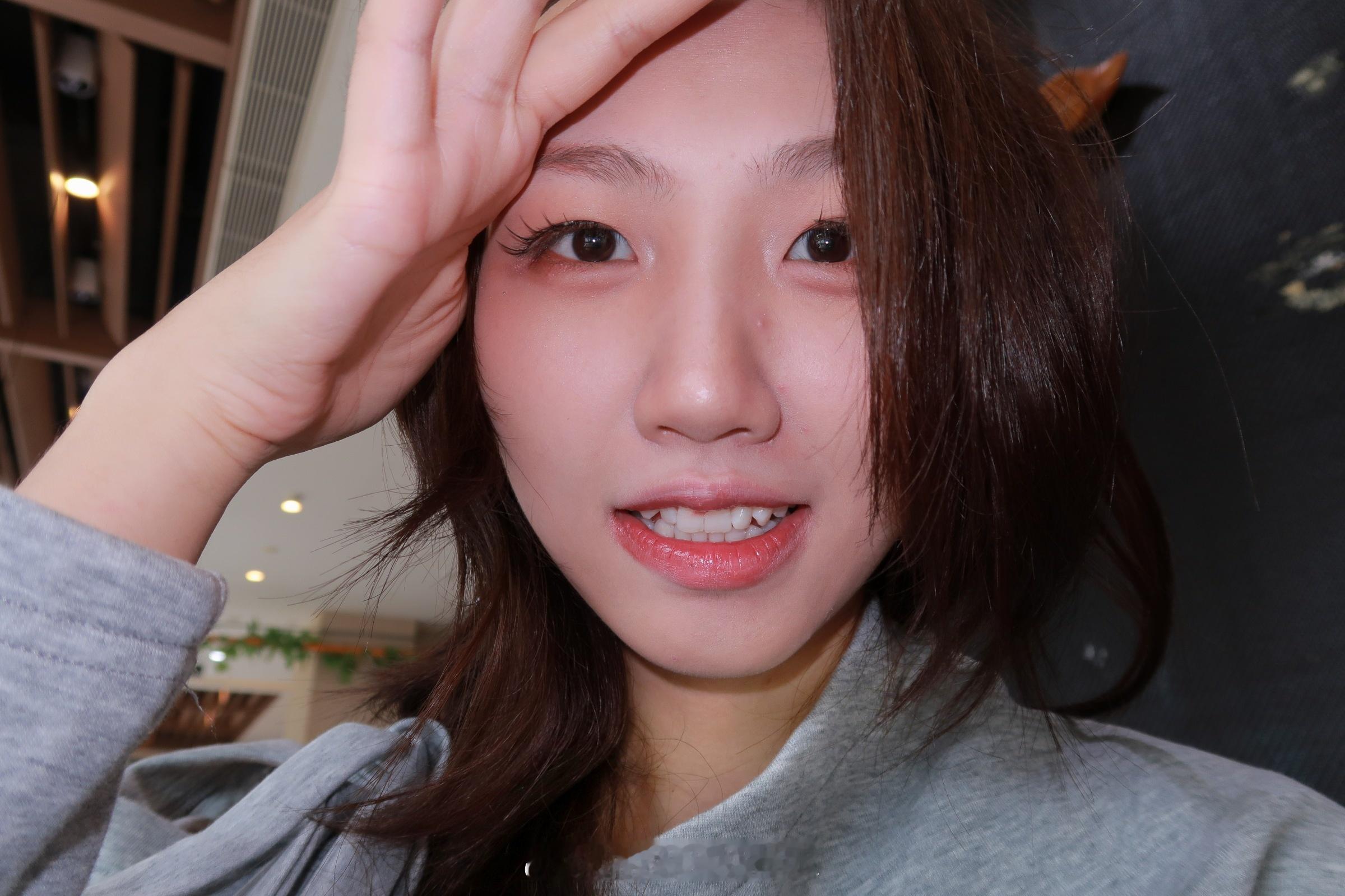 #长痘时真正需要忌口的食物#能吃辣就好，刚好最近熬夜熬的我又长起了痘痘[泪]但是